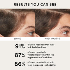 OUAI Scalp Serum – Hydrating Leave-In Treatment with Hyaluronic Acid & Adaptogens for Thicker, Fuller, Healthier Hair (2 fl. oz.)