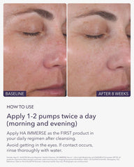 ALASTIN Skincare Hyaluronic Acid HA IMMERSE Moisturizing Face Serum (1 oz) | Restorative Serum for Dry, Dehydrated Skin | Radiant, Glowing Complexion